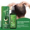South Moon 100% Natural Organic Rapid Regrowth Ginger  Bald Hair Treatment Oil For Anti Hair Loss Growth Spray